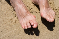 Causes and Symptoms of Hammertoes
